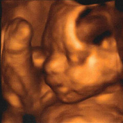 Three-dimensional ultrasound of a child in its mother's womb.